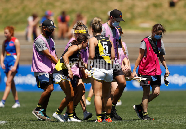 AFLW 2022 Round 05 - Western Bulldogs v Richmond - 906649