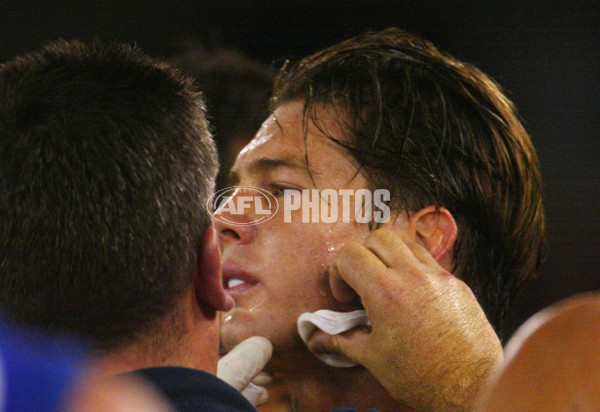 AFL 2003 Rd 10 - Essendon v West Coast - 121629