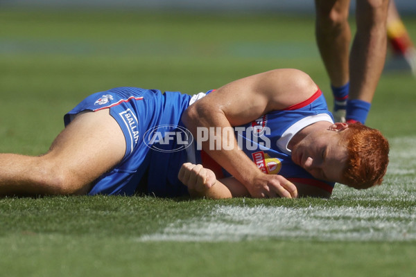 AFL 2024 Round 02 - Western Bulldogs v Gold Coast - A-46667350