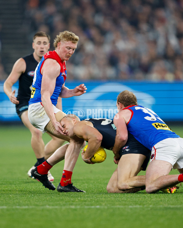 AFL 2024 Round 09 - Carlton v Melbourne - A-49048627