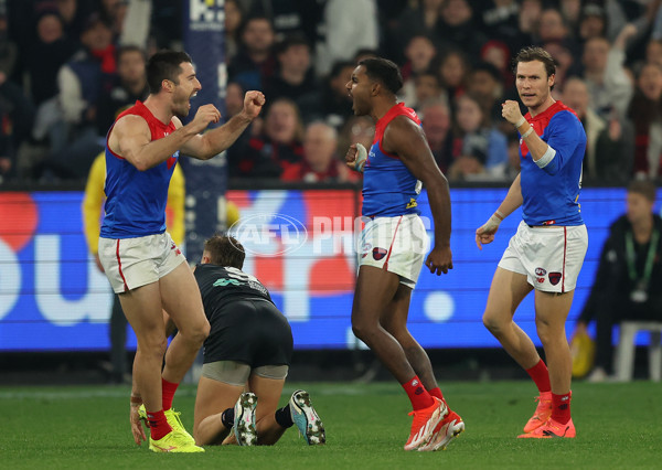 AFL 2024 Round 09 - Carlton v Melbourne - A-49051881