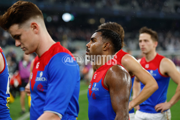 AFL 2024 Round 09 - Carlton v Melbourne - A-49051955