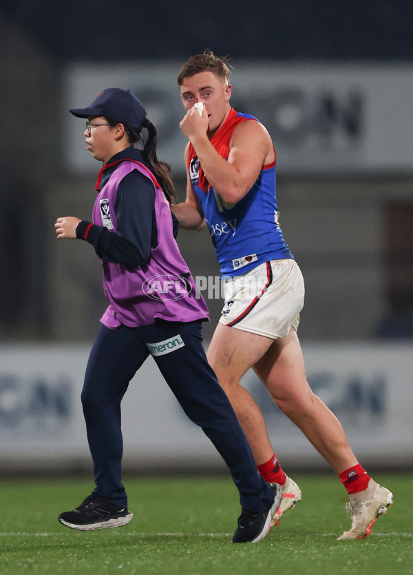 VFL 2024 Round 07 - Carlton v Casey Demons - A-49086245