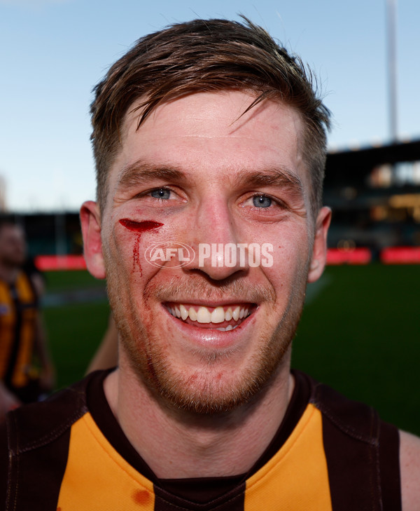 AFL 2024 Round 09 - Hawthorn v St Kilda - A-49118139