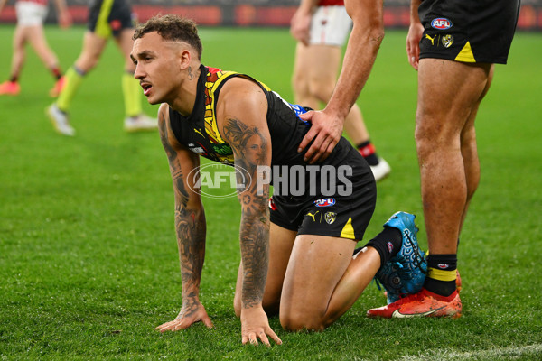 AFL 2024 Round 11 - Richmond v Essendon - A-49683842