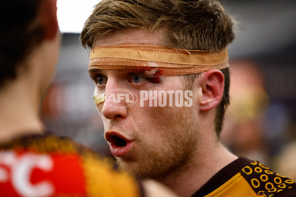 AFL 2024 Round 11 - Hawthorn v Brisbane - A-49706646