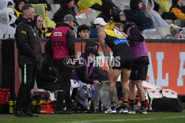 AFL 2024 Round 16 - Richmond v Carlton - A-51489605