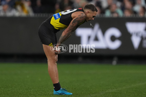 AFL 2024 Round 16 - Richmond v Carlton - A-51489664