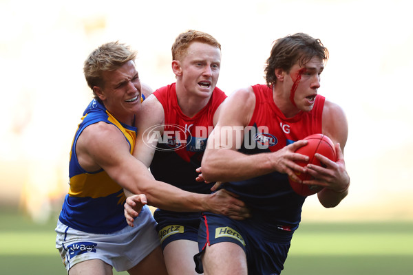 AFL 2024 Round 17 - Melbourne v West Coast - A-51683511