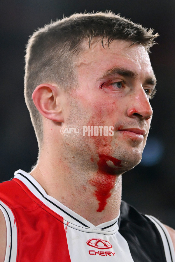 AFL 2024 Round 17 - St Kilda v Sydney - A-51702542