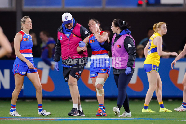 AFLW 2024 Round 03 - Western Bulldogs v West Coast - A-53986174