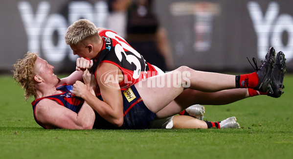 AFL 2025 Round 05 - Melbourne v Essendon - A-58555782