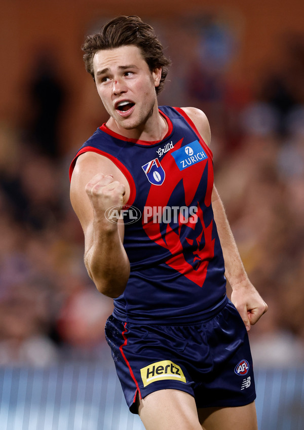 AFL 2025 Round 05 - Melbourne v Essendon - A-58557752