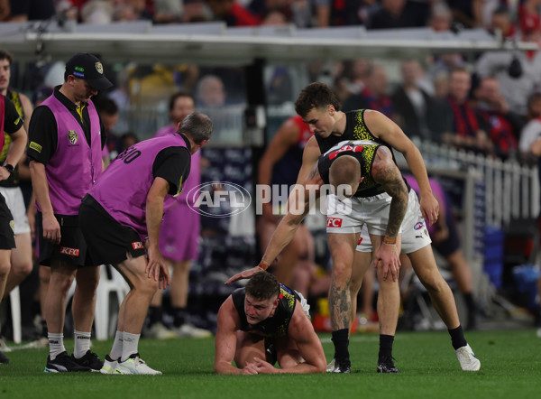 AFL 2025 Round 07 - Melbourne v Richmond - A-58932227