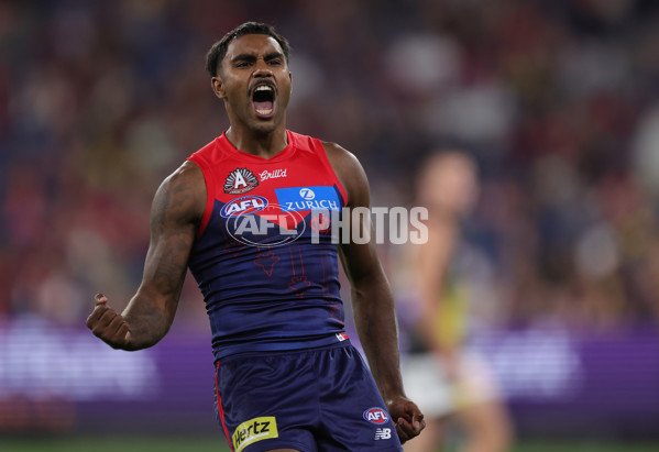 AFL 2025 Round 07 - Melbourne v Richmond - A-58932259