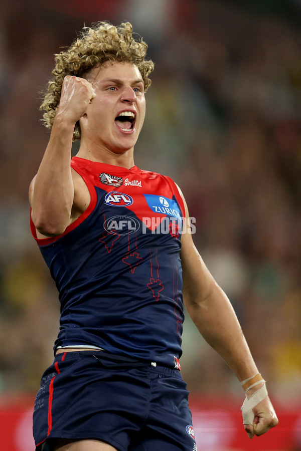 AFL 2025 Round 07 - Melbourne v Richmond - A-58933089