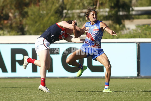VFL 2025 Round 07 - Footscray Bulldogs v Casey Demons - A-59394063