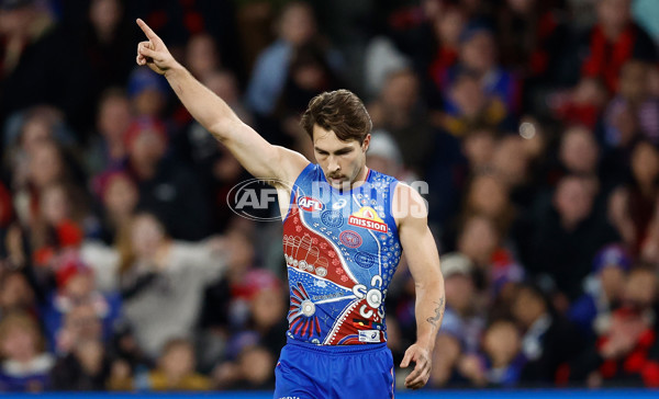 AFL 2025 Round 10 - Western Bulldogs v Essendon - A-59532364