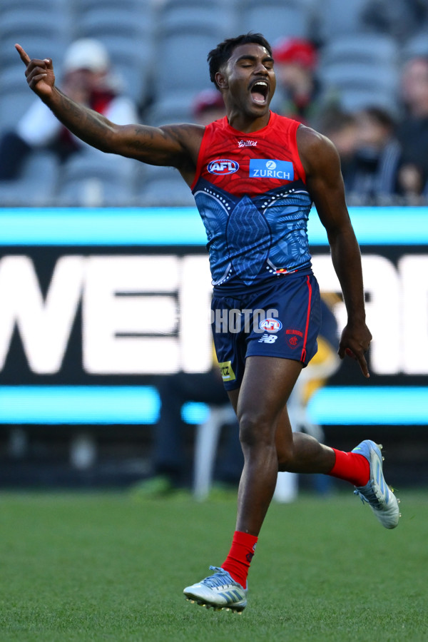 AFL 2025 Round 11 - Narrm v Sydney - A-59693267