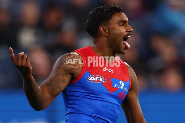 AFL 2025 Round 19 - Carlton v Melbourne - A-60632174