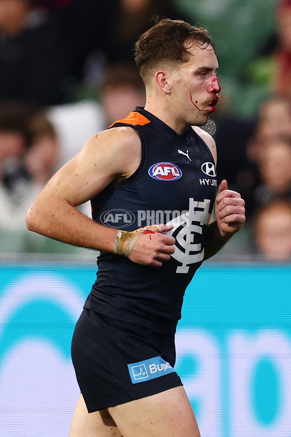 AFL 2025 Round 19 - Carlton v Melbourne - A-60638573