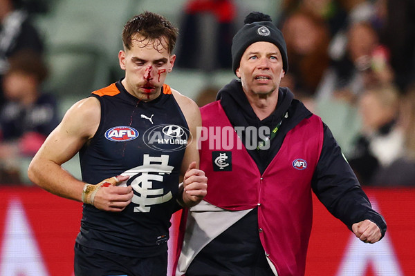 AFL 2025 Round 19 - Carlton v Melbourne - A-60638575