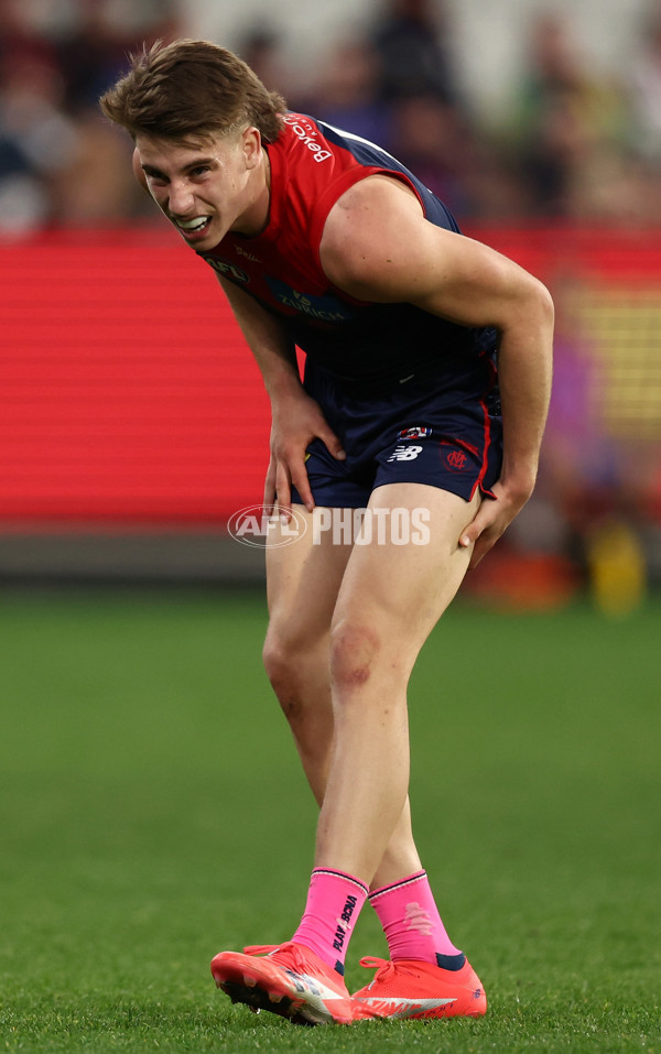 AFL 2025 Round 22 - Melbourne v Western Bulldogs - A-61275405
