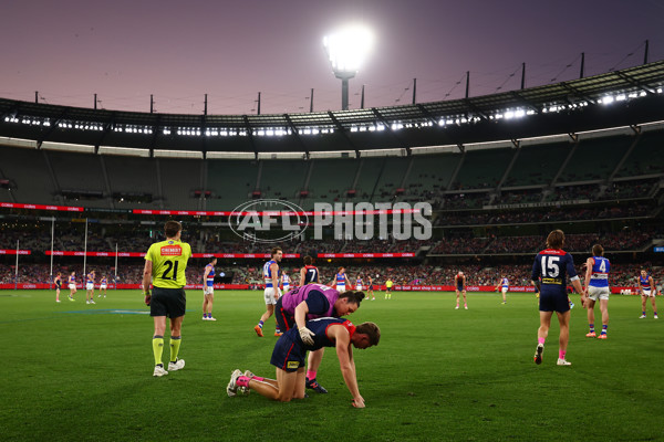AFL 2025 Round 22 - Melbourne v Western Bulldogs - A-61281058