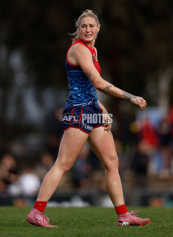 AFLW 2025 Round 03 - Collingwood v Narrm - A-62146711